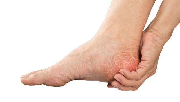 What causes foot numbness in runners 