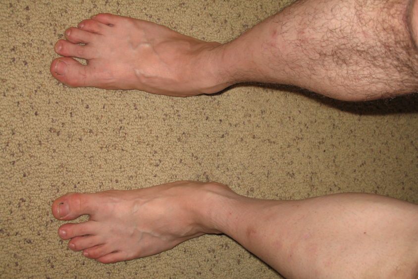 Shaving Your Legs