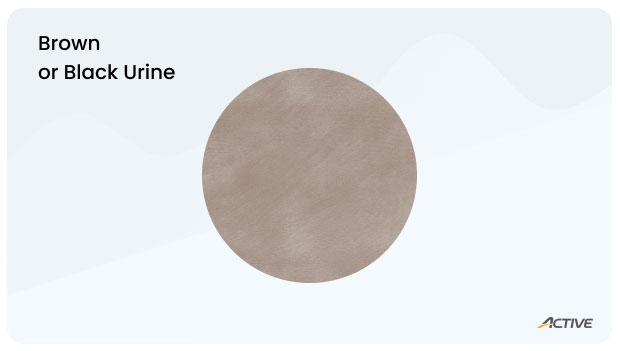 Urine-color-chart_brownblack