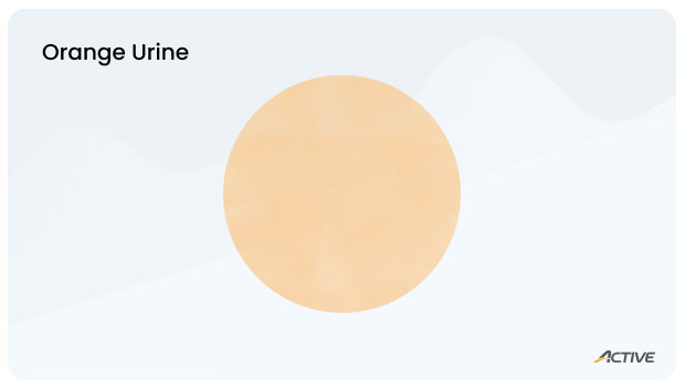 Urine-color-chart_orange