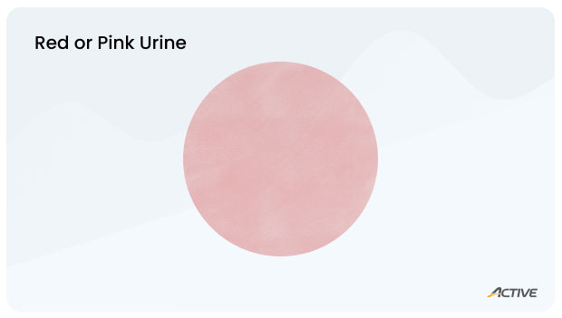 Urine-color-chart_redpink