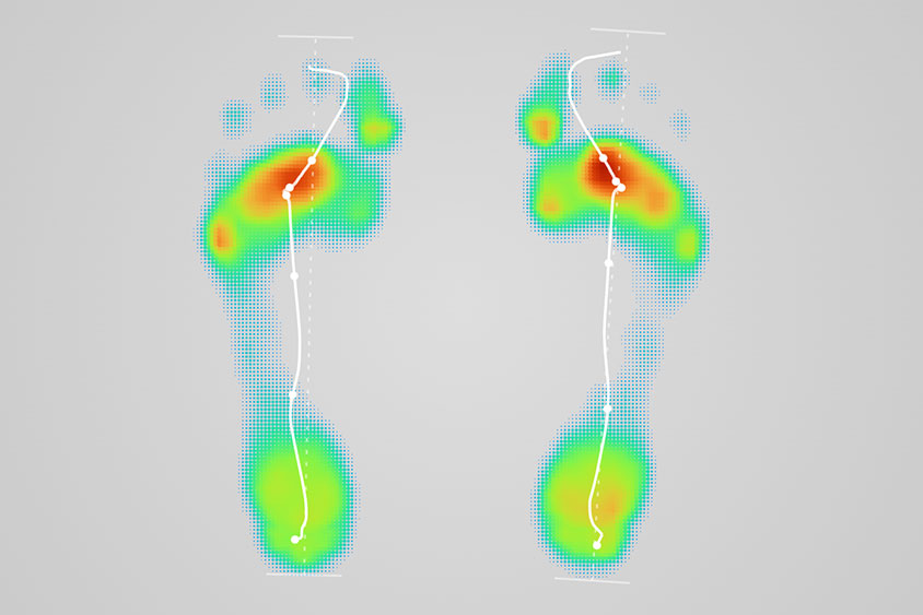 FootScan_844x563